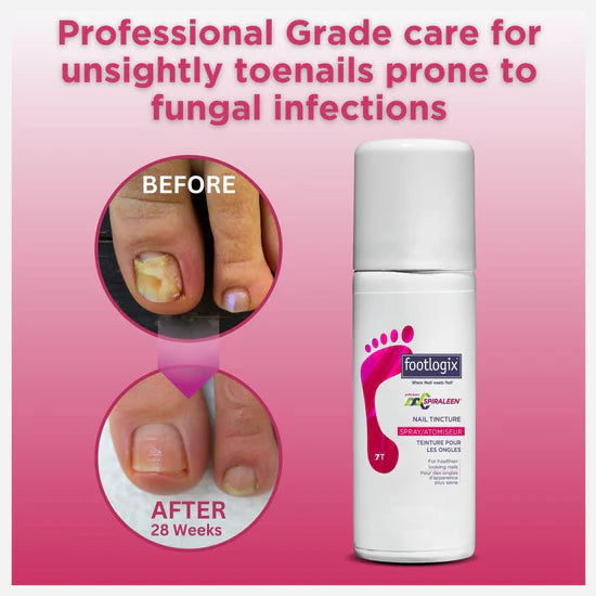 NAIL TINCTURE SPRAY